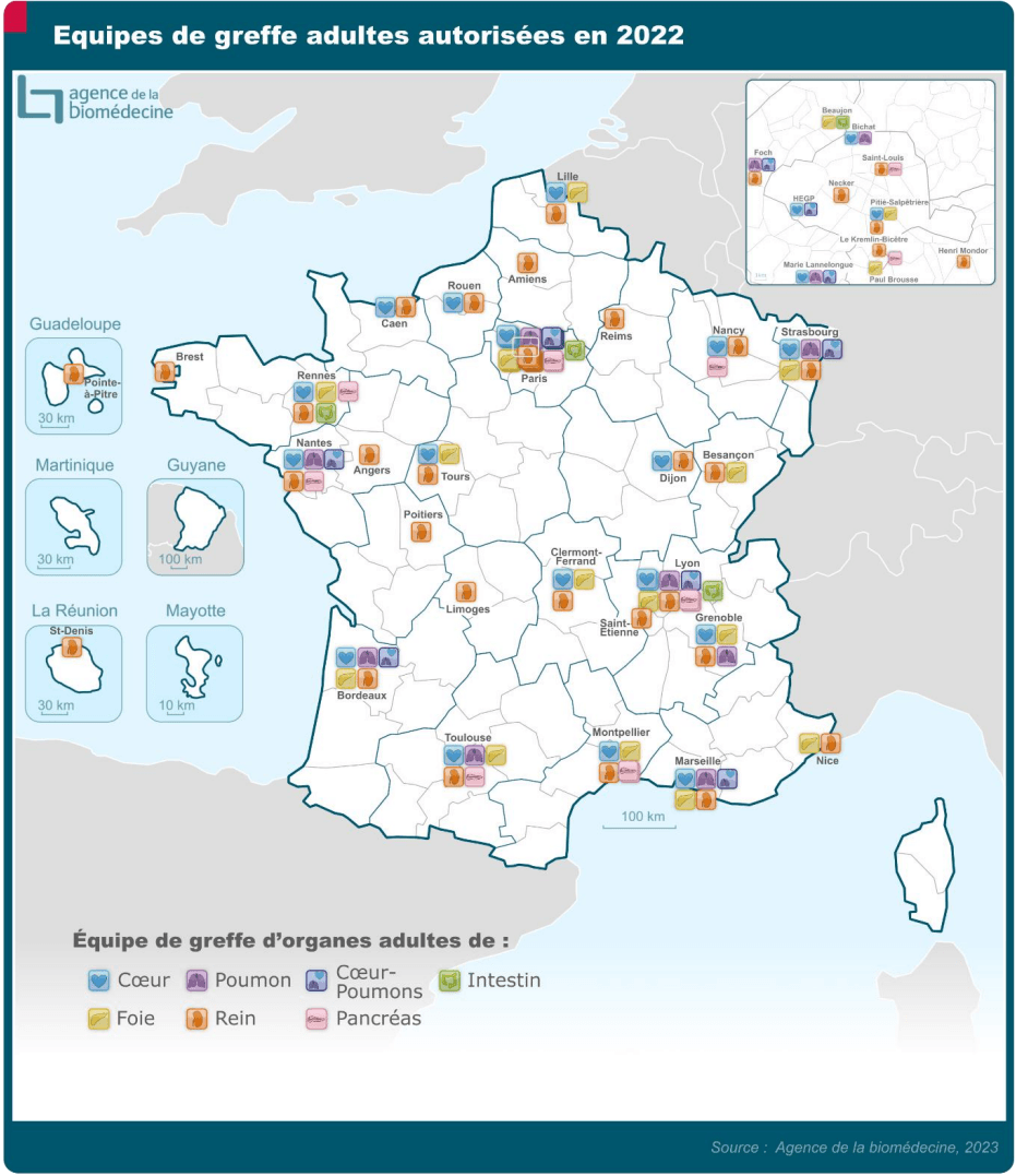 Répartition des centres de greffe sur le territoire français