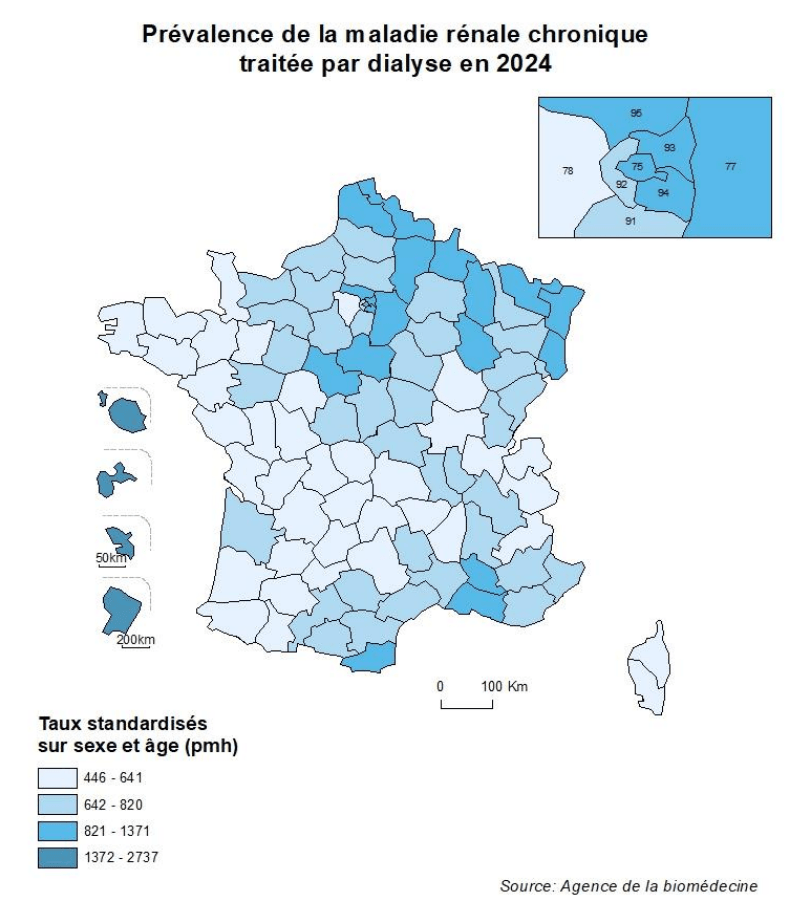 Répartition de l’insuffisance rénale chronique terminale sur le territoire français